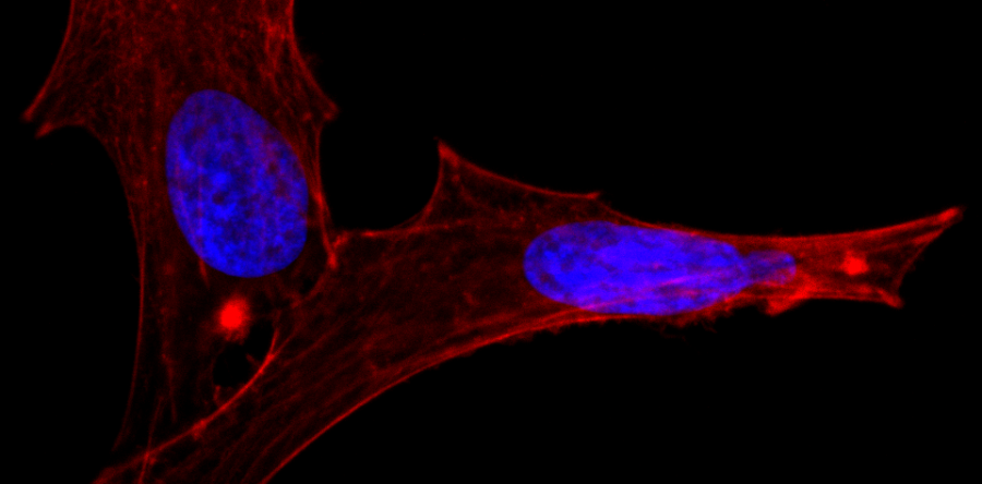 Entenda o comportamento mecânico de células vivas