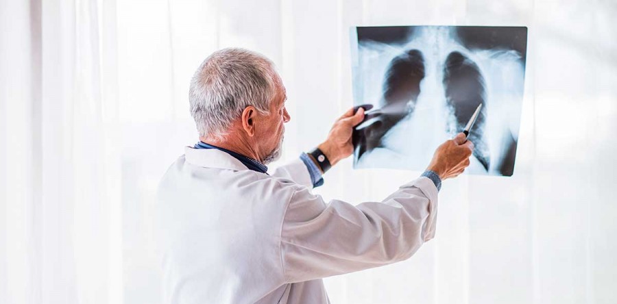 Agosto Branco: Conscientização sobre Câncer de Pulmão