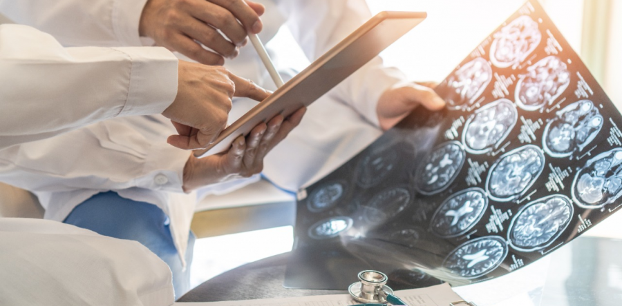 HGF participa de estudo mundial sobre AVC hemorrágico