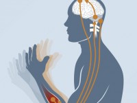 Lesões cerebrais, causadas por acidentes ou AVCs, por exemplo, além de infecções como meningites e encefalites podem ser associadas à epilepsia. Existem ainda as causas genéticas ou situações determinantes no parto, como a falta de oxigenação no cérebro do recém-nascido (Foto: Reprodução/Internet)